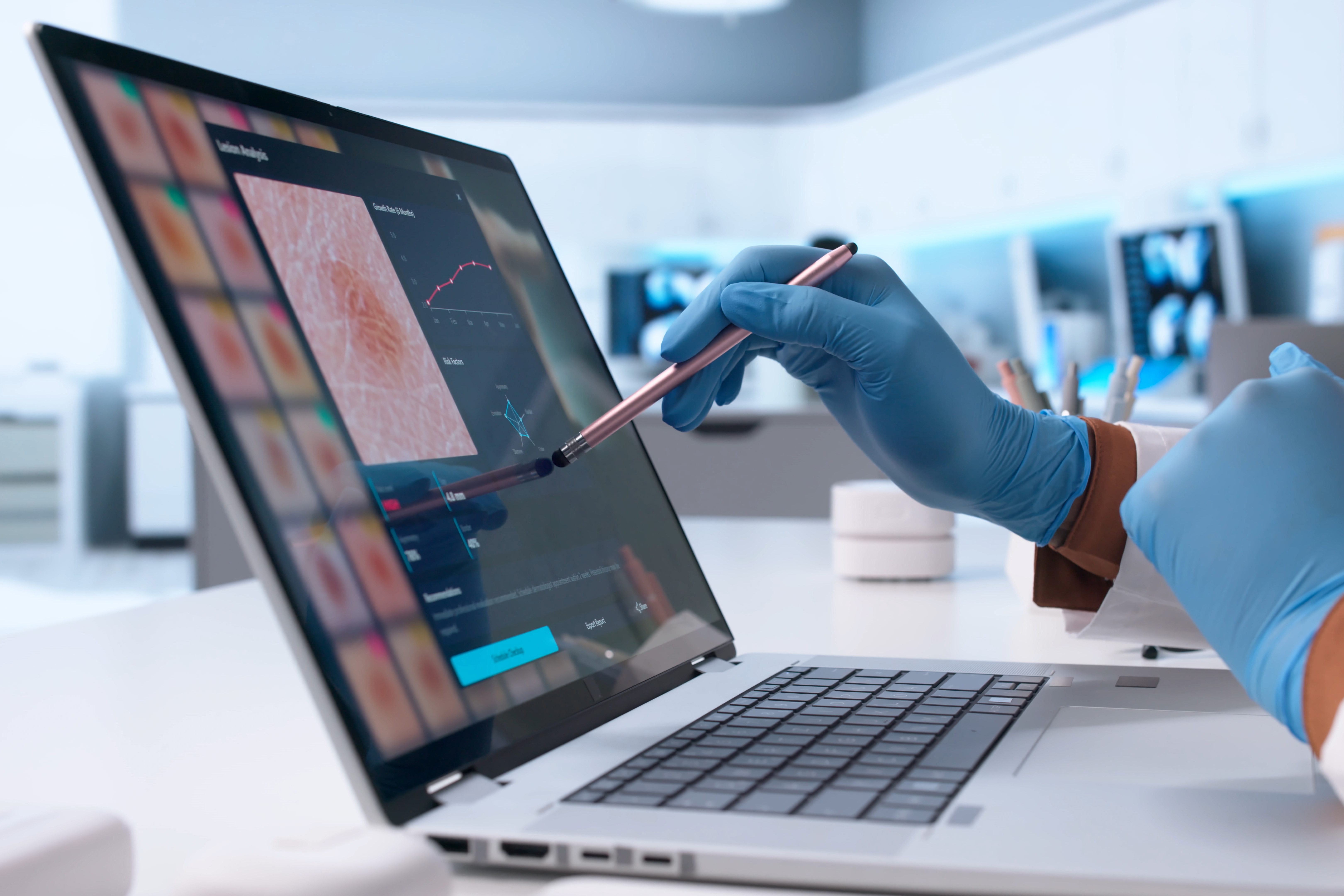 Medical AI Help Depends on Expertise, Nature Medicine Study Finds