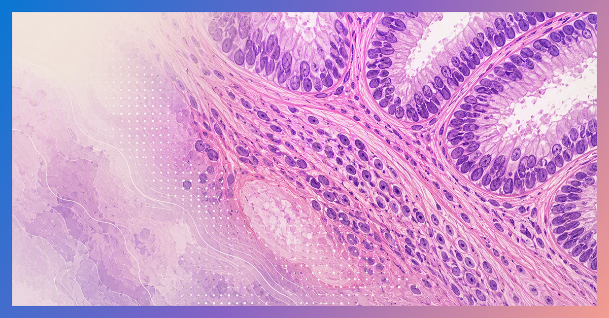 Microsoft Research introduces PRISM2 for pathology AI